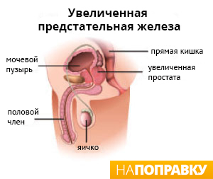 анатомия мочеполовой системы мужчины с увеличенной предстательной железой