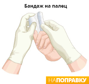 бандаж на палец при переломе